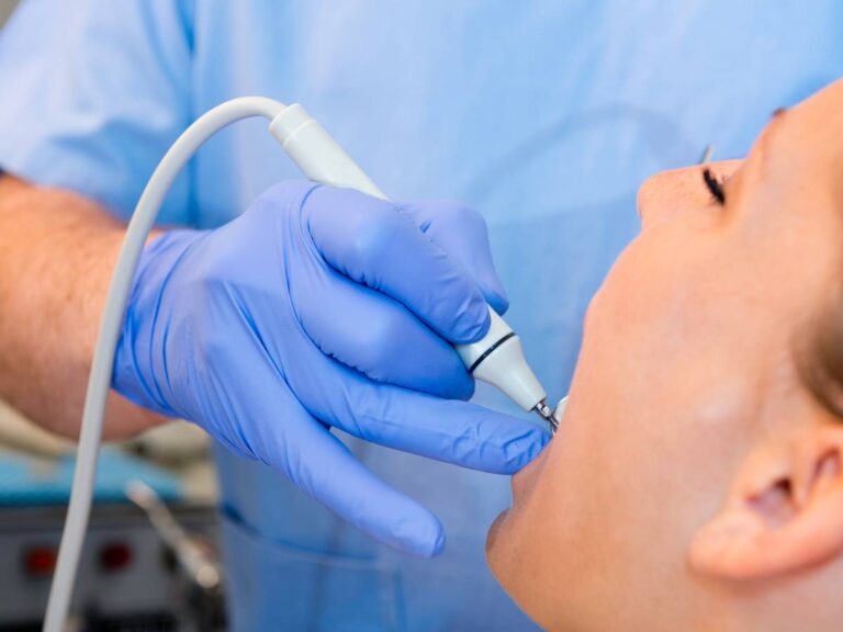 Usuwanie kamienia Obrazek w artykule Domowe sposoby na usunięcie kamienia nazębnego. Skuteczne i proste metody walki z kamieniem nazębnym