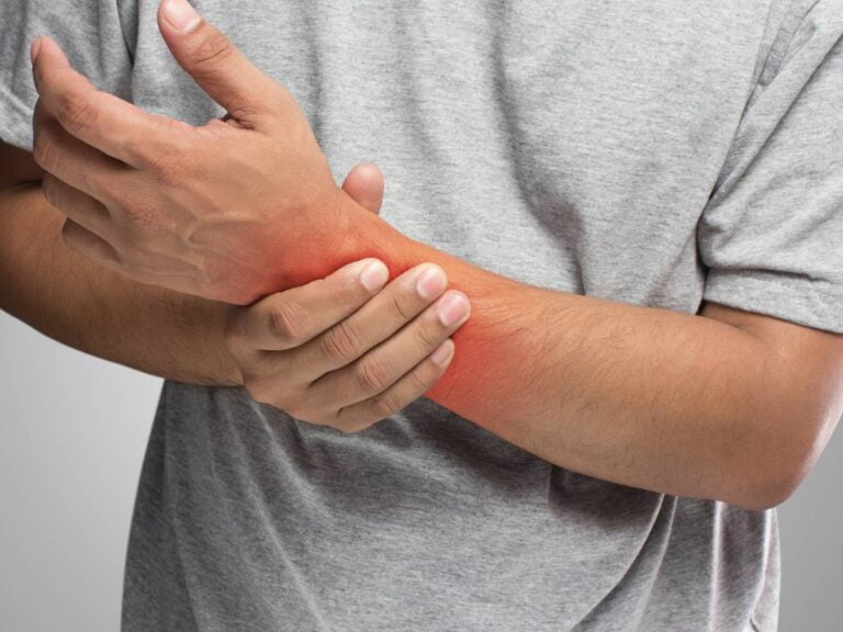 Ręka po złamaniu. Obrazek w artykule Domowe sposoby na opuchliznę po złamaniu. Jak łagodzić ból i zmniejszyć opuchliznę po złamaniu?