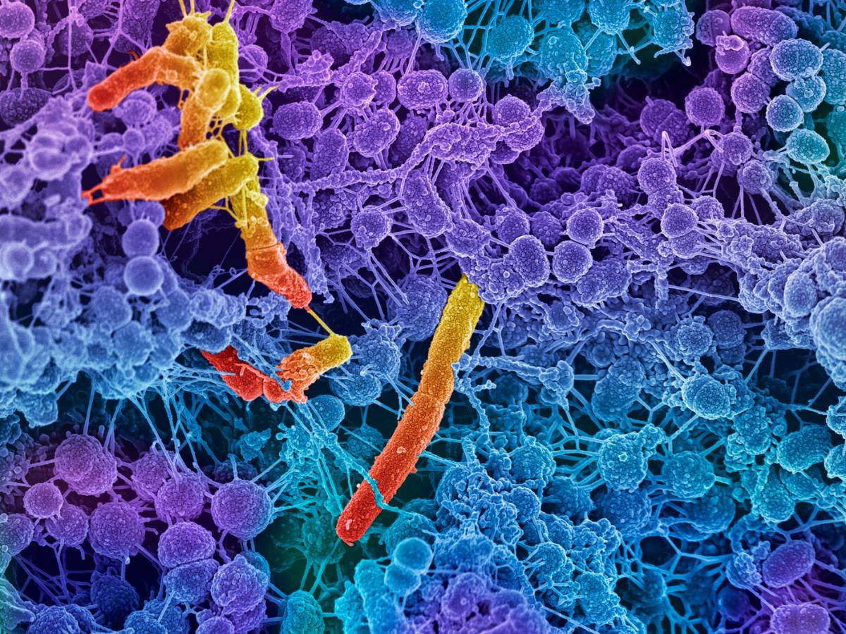 Fotografia pod mikroskopem. Obrazek w artykule Naturalny sposób na paciorkowce: Skuteczne sposoby leczenia bez antybiotyków