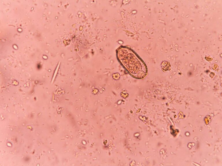 Grafika pasożyty. Rosyjski sposób na pasożyty: skuteczne metody walki z pasożytami