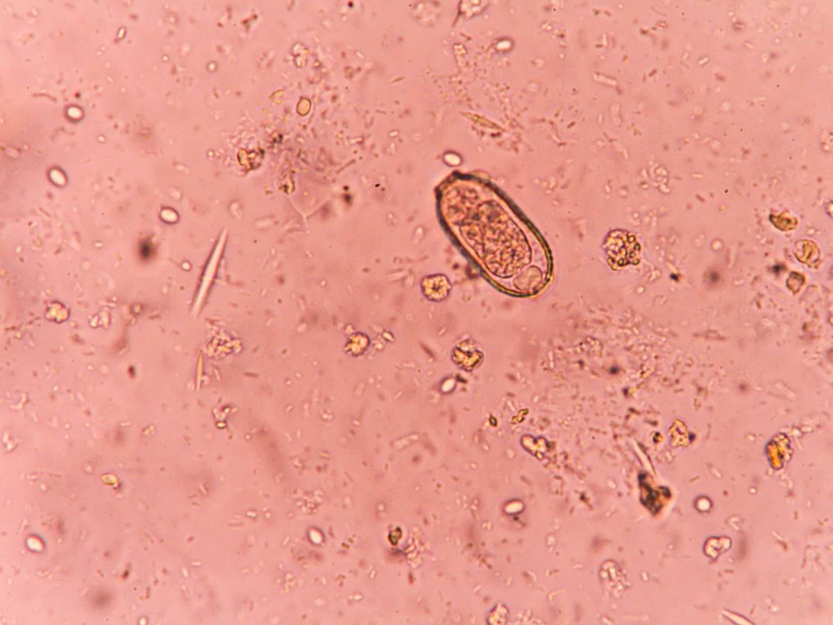 Grafika pasożyty. Rosyjski sposób na pasożyty: skuteczne metody walki z pasożytami